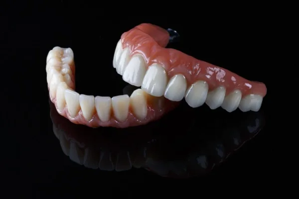 Implante dentário na Odonto Rir